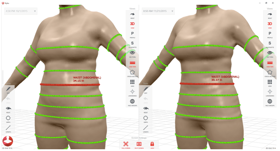 3D Body Scan